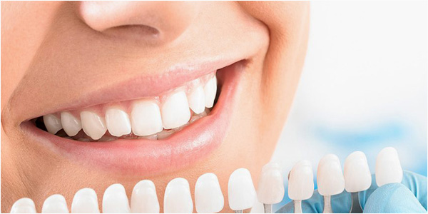 FÜR IHR SCHÖNSTES LÄCHELN